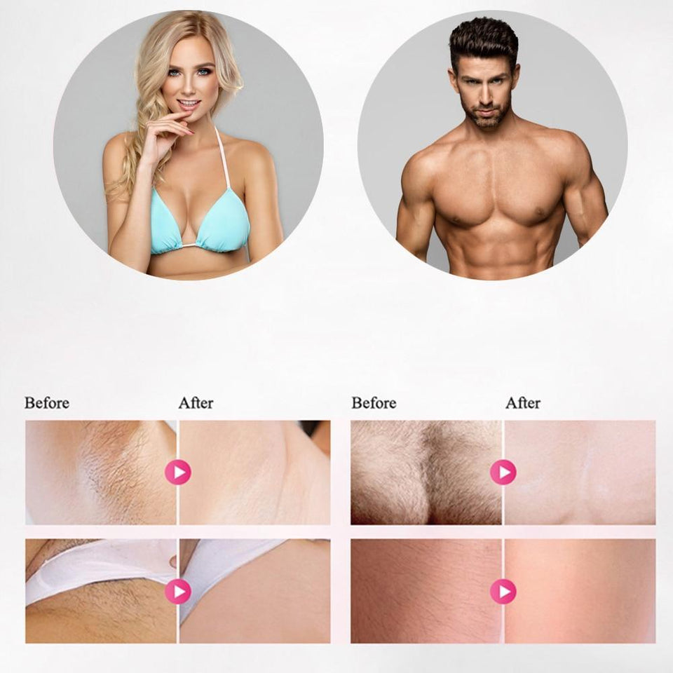 IPL epilator laser hair removal electric photo women painless threading hair remover machine - LuxxStores