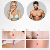 IPL epilator laser hair removal electric photo women painless threading hair remover machine - LuxxStores